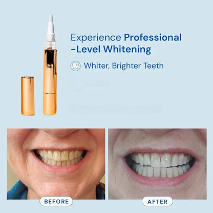 Mirova Teeth Whitening Stick
