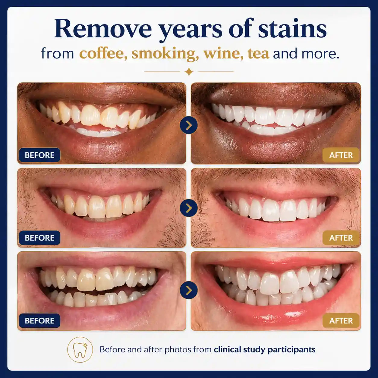 Mirova Teeth Whitening Stick