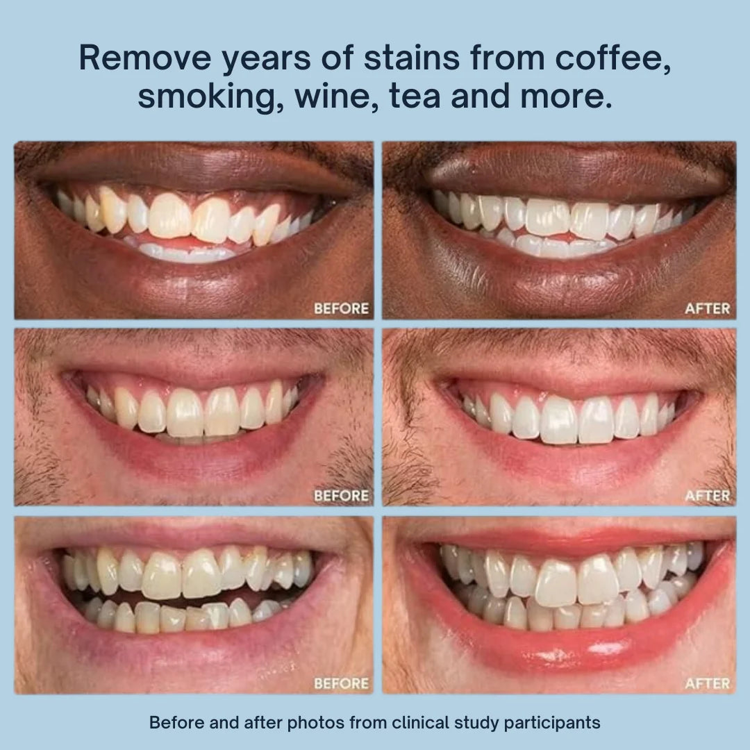 Mirova Teeth Whitening Stick