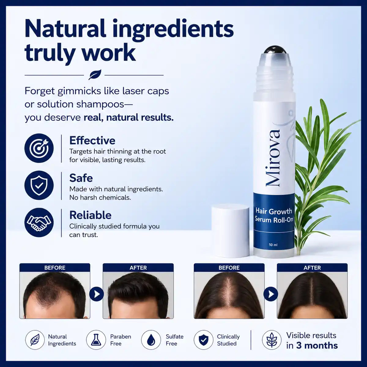 Mirova Hair Growth Serum