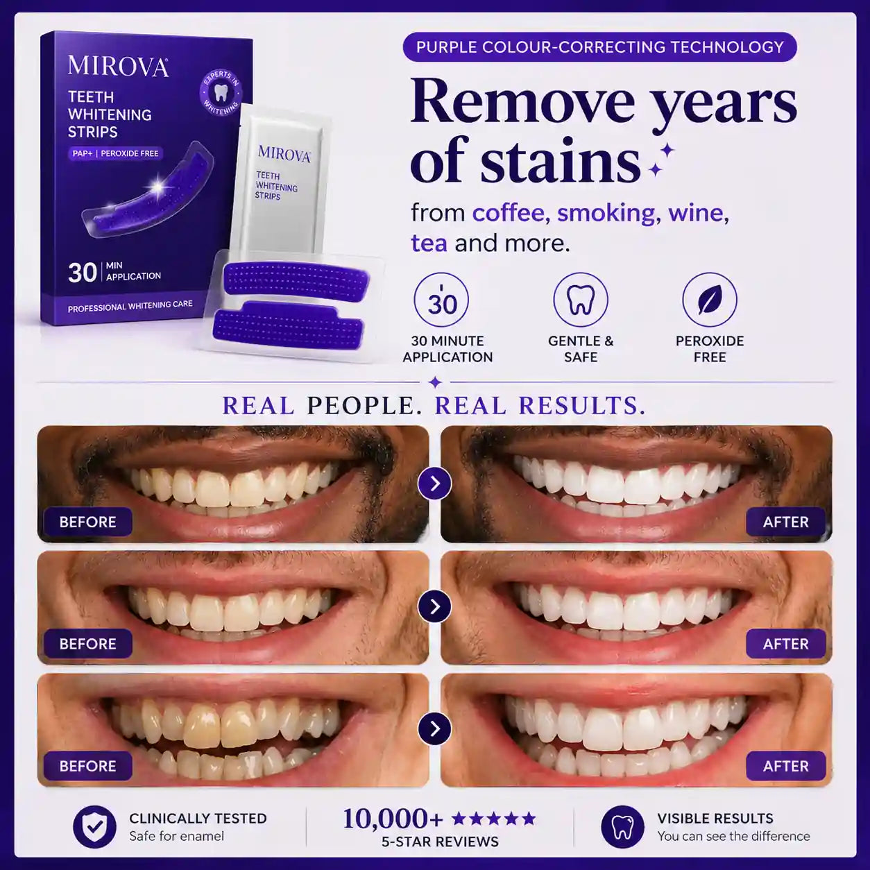 Mirova Whitening Strips